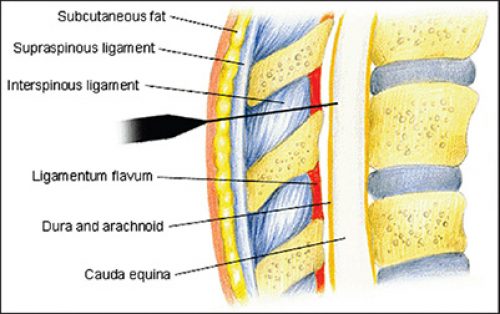 spinal.400jpg